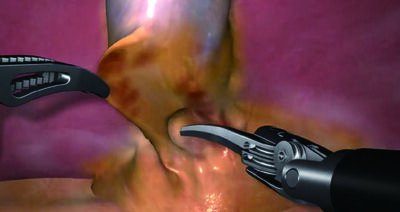 Revo-Sim: Procedure training